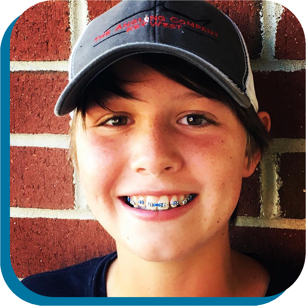 Boy smiling with braces Gardner & La Rochelle Orthodontics in Richmond, VA