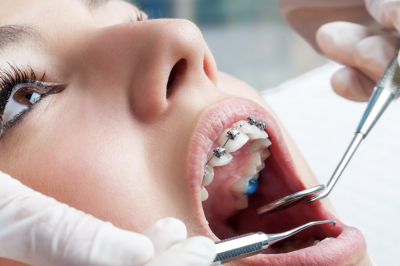 Can-I-Get-Braces-with-Periodontitis? Gardner & La Rochelle Orthodontics in Richmond, VA